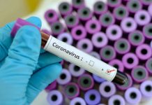 Togo confirms first coronavirus case/newsheadline247.com