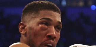 Heavyweight Boxing: Joshua heads to hospital to fix broken eye after loss to Usyk