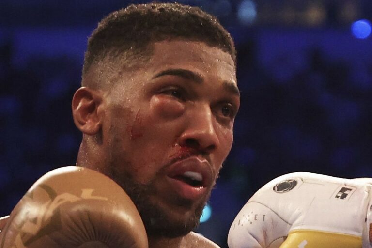 Heavyweight Boxing: Joshua heads to hospital to fix broken eye after loss to Usyk