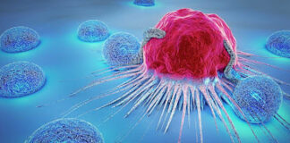 Cancer rising in people under 50 – Study