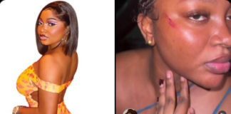 Influencer Papaya Ex Alleges Assault by Police Officer in Lagos