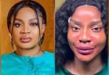 Uche Ogbodo Reveals Facial Rejuvenation Aftermath, Says She’s Hopeful