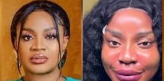 Uche Ogbodo Reveals Facial Rejuvenation Aftermath, Says She’s Hopeful